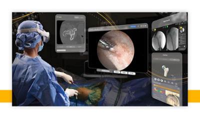 Composição de divulgação do SportSuite Vision com cirurgião e telas. Não é um registro independente da cirurgia.